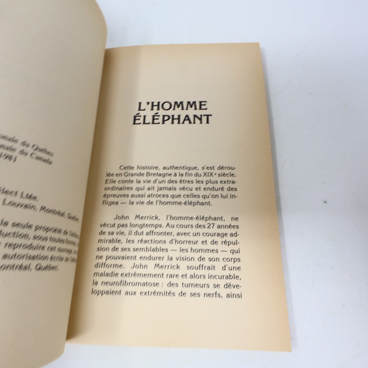 1981 Le Destin Tragique de l'Homme Éléphant Jutzi Biographie Sélect Français 80s