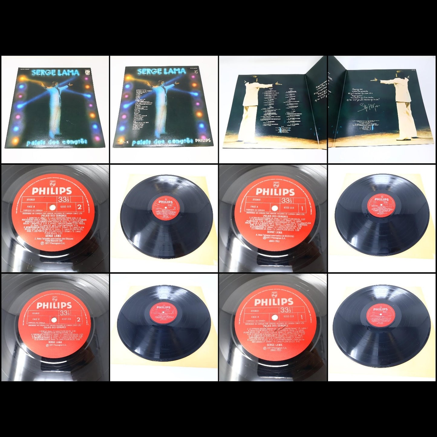 Serge Lama Lot 4 Disques LP Record 1973-1980 Philips Je Suis Malade/Chez Moi