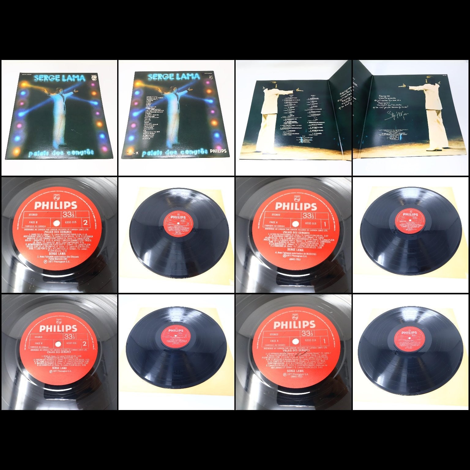 Serge Lama Lot 4 Disques LP Record 1973-1980 Philips Je Suis Malade/Chez Moi