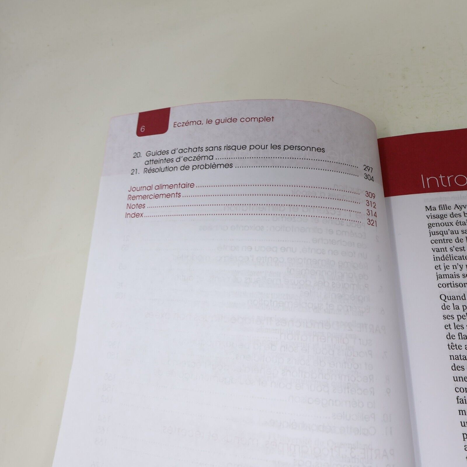 2013 Eczéma le Guide Complet de Karen Fischer Santé Editions Caractere Français